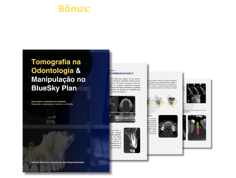 masterclass-tomografia-na-pratica-7